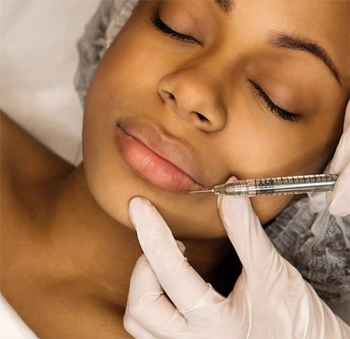 DERMAL FILLER